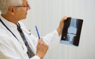 How Does a Knee Replacement Work?