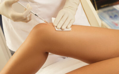 What Kind of Knee Injections Can I Get for Arthritis?